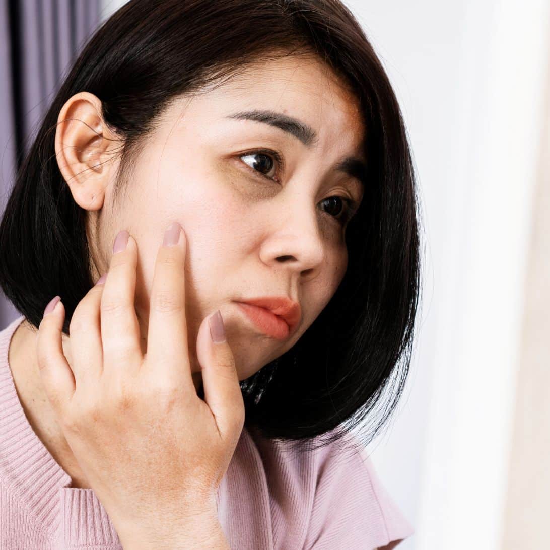 Vrouw heeft last van donkere kringen onder ogen