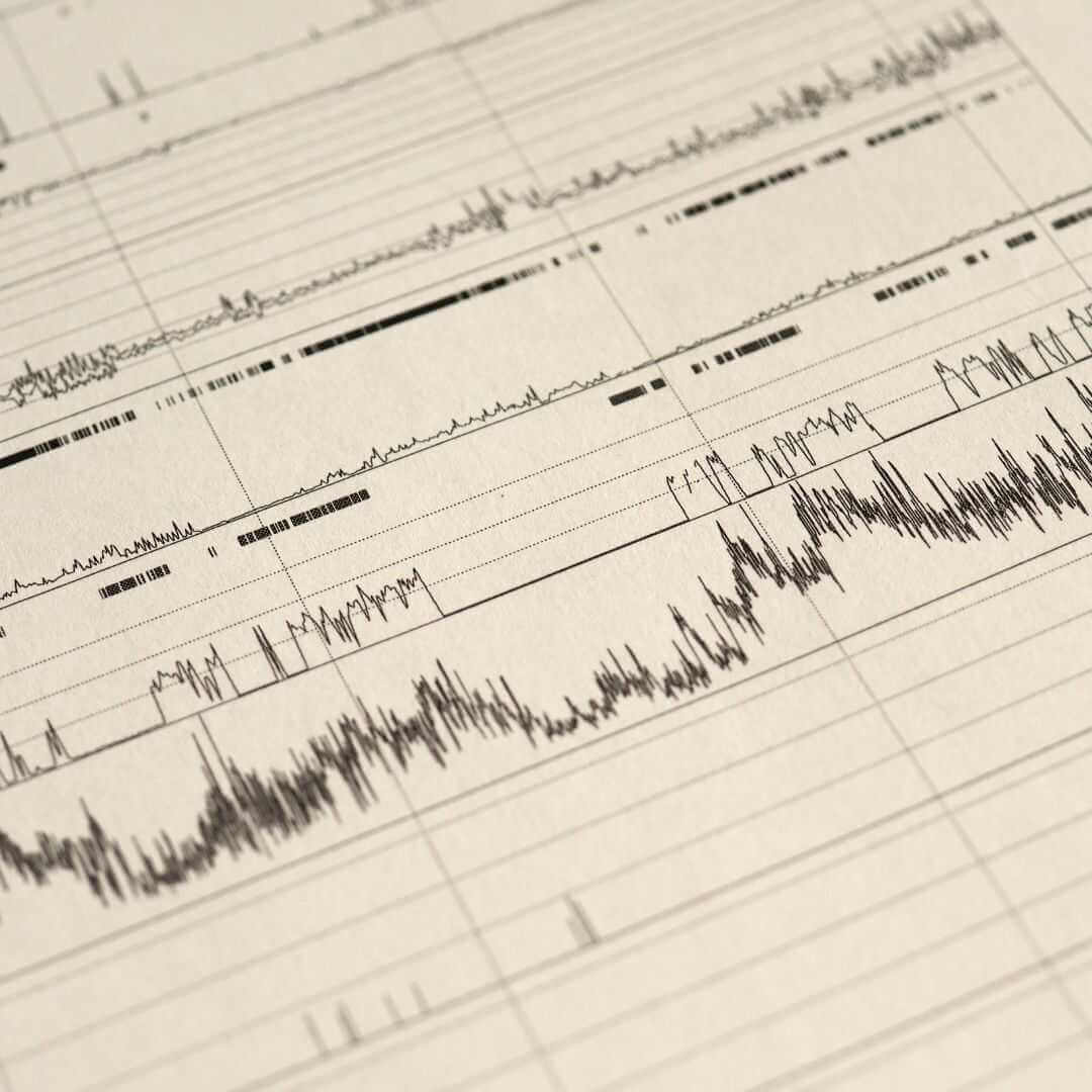 Het grote slaaponderzoek 2008: waarom liggen we wakker?